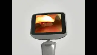 VideoLaringoscopio Insighter IS3 R