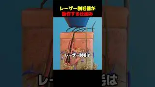 レーザー脱毛器が動作する仕組み