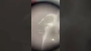 Lotion Under A Magnifying Glass