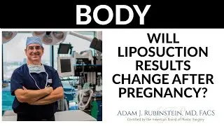 Plastic Surgery Truths - Will Liposuction results change after pregnancy?
