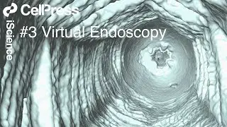 Micro CT Imaging of the Tobacco Hornworm Caterpillar : Virtual Endoscopy of the Alimentary Tract