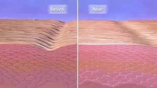 Mega-C product animation