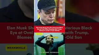 Elon Musk&rsquo;s Black Eye Sparks Viral Speculations! 🌪️