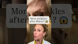More Wrinkles after Botox? #botox #beauty #skincare #filler