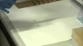 Allestimento di uno striscio ematico