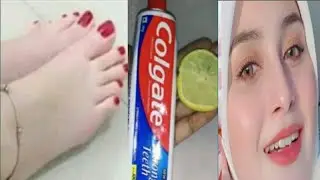 Skin Whitening with Colgate Toothpaste at Home | Hand and Feet whitening remedy.