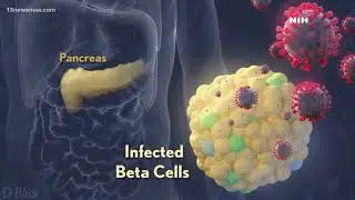 New studies find that COVID-19 could lead to diabetes