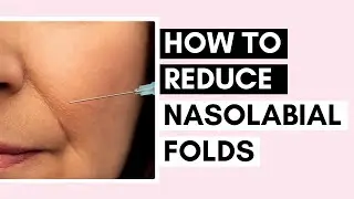 8 Ways To Reduce Nasolabial Folds | Fillers, Threads, Face Massage, And More Tips