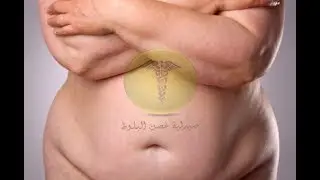 اذا عندج  قابلية للسمنة  ضروري  تشوفين  الفيديو