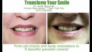 Cosmetic Dentist in New Jersey - Dr. Jacob Shrayman
