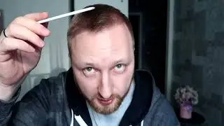 4 месяца после пересадки волос, Стамбул , Turkey Hair Academy