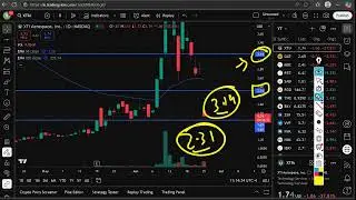 XTIA Stock (XTI Aerospace stock) XTIA STOCK PREDICTION XTIA STOCK analysis XTIA stock news today