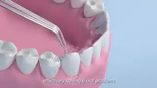 Water Dental Flosser