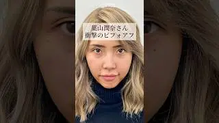【クマ取り】葉山潤奈さん。衝撃のビフォアフ#shorts