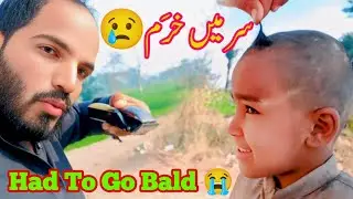Severe Scalp Infection 😢 Had to Shave His Head video 2026