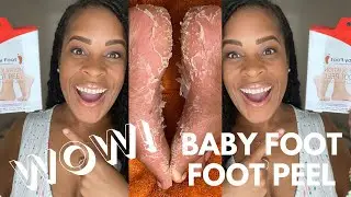 ***BABY FOOT EXFOLIATING FOOT  PEEL IS BOMB!*** FULL REVIEW!