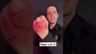 How much do you love paper cuts? #medical #survival #health