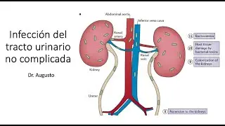 Infección de vías urinarias: Microbiología, Cuadro clínico, Clasificación y Tratamiento actual.
