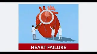 Management of ADHF &ndash; Drugs, MOA & Side Effects