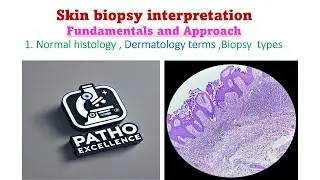 Skin Biopsy Interpretation – Fundamentals Approach Histology, Dermatology Terms & Biopsy Types Ep 1