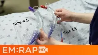 Air-Q Supraglottic Airway