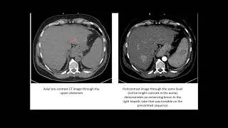 Contrast agents in radiology - RSCP Video Curriculum