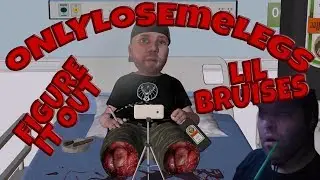 ONLYLOSEmeLEGS - Figure It Out Lil Bruises (UnOfficial Video) - ONLYUSEmeBLADE