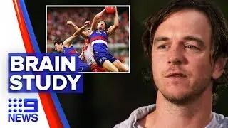 Retired AFL player to donate brain for concussion research | Nine News Australia