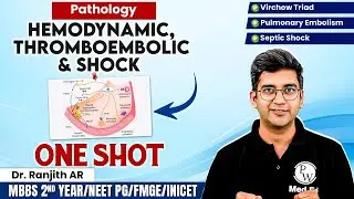 Hemodynamic, Thromboembolic & Shock | Pathology ONE SHOT | MBBS 2nd Year Lecture | Dr Ranjith Sir