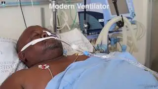 The History of Brain Death Determination