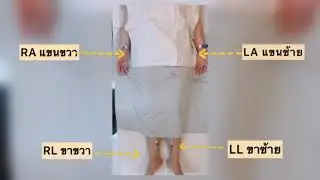 การตรวจคลื่นไฟฟ้าหัวใจ EKG
