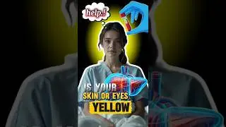 Day in OPD patient with jaundice l explained #medical #shorts