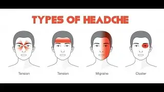 Pharmacotherapy of migraine; acute therapies to stop attacks, preventive therapies