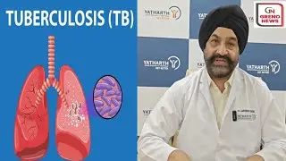 Tuberculosis Symptoms & Prevention | Interview with Dr. Sarvinder Singh, Yatharth Hospital