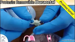 Pr&oacute;tesis: Removible Est&eacute;tico Duracetal