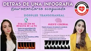 INFOGRAF&Iacute;A #2 // NEUROMONITOREO By Karla Hdz. y Pao Villa