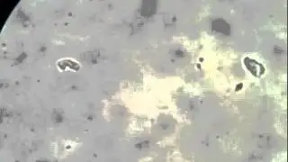 Insect Larvae under a Microscope