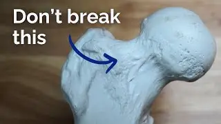 How to prevent a bone stress injury