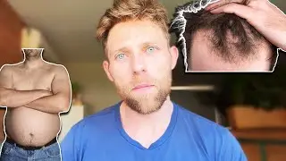 Why I think Dadbods, Bald Acceptance, and more Is Bullsh*t