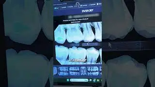 This A.I. can see cavities before you do.