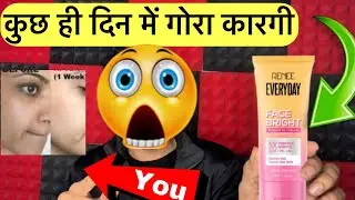 RENEE Face Cream सच में Brightening करती है? 😲 7 दिन का सच |RENEE cream review hindi 