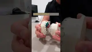 🦷 𝗗𝗶𝗲 𝗩𝗼𝗿𝘀𝗰𝗵𝘂𝗯-𝗗𝗼𝗽𝗽𝗲𝗹𝗽𝗹𝗮𝘁𝘁𝗲