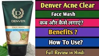 Denver Acne Clear Face Wash Review | Denver Acne Clear Face Wash How To Use #DenverAcneFaceWash
