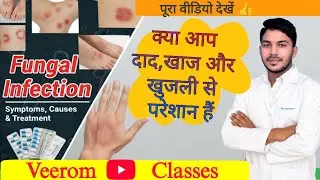 Fungal Infection Causes ,Symptoms, Prevention And Treatment, दाद खाज और खुजली के कारण,बचाव और इलाज 👍