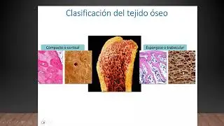 Histología del tejido óseo