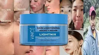 Vince Skin Lightening Night Cream | Honest Review