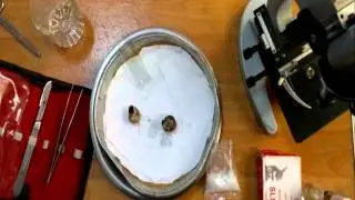 Raduila of land snail