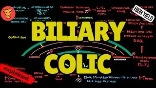 Biliary Colic EXPLAINED: Pathogenesis, Symptoms & Treatment (USMLE High-Yield Beginner&rsquo;s Guide)