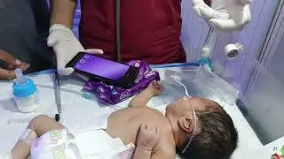 How to Give Formula Feeding Through NG Tube | NICU Nurse Step-by-Step Guidem