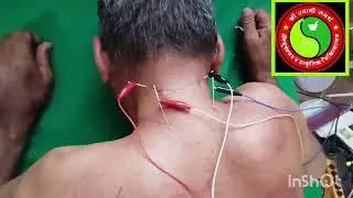 Appointment book now 9970022804.           Shri Swami Samarth Acupuncture Prakrutic Chikitsalay 
